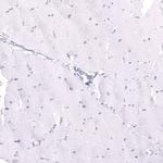 LRRC55 Antibody in Immunohistochemistry (Paraffin) (IHC (P))