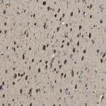 SEC62 Antibody in Immunohistochemistry (IHC)