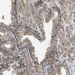SEC62 Antibody in Immunohistochemistry (IHC)