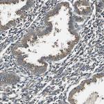SEC62 Antibody in Immunohistochemistry (IHC)