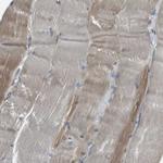 SEC62 Antibody in Immunohistochemistry (IHC)