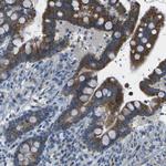 TMEM120B Antibody in Immunohistochemistry (Paraffin) (IHC (P))
