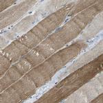 TMEM120B Antibody in Immunohistochemistry (Paraffin) (IHC (P))