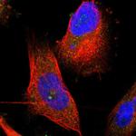 TMEM120B Polyclonal Antibody