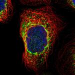 PREB Polyclonal Antibody