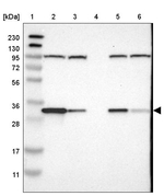 CYB5R1 Antibody in Western Blot (WB)