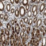 TMX3 Polyclonal Antibody