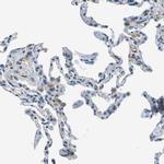 PTGIS Antibody in Immunohistochemistry (Paraffin) (IHC (P))