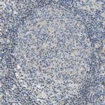 PTGIS Polyclonal Antibody