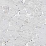 MYOF Antibody in Immunohistochemistry (Paraffin) (IHC (P))