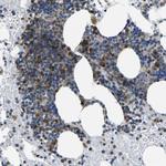 TMCC2 Antibody in Immunohistochemistry (Paraffin) (IHC (P))