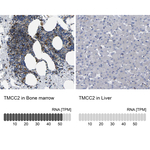 TMCC2 Polyclonal Antibody