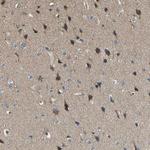 TMCC2 Antibody in Immunohistochemistry (Paraffin) (IHC (P))