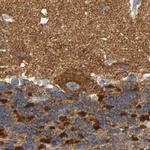 GDAP1 Antibody in Immunohistochemistry (IHC)
