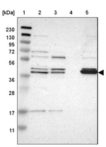 GDAP1 Antibody in Western Blot (WB)