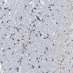 TMCC3 Antibody in Immunohistochemistry (Paraffin) (IHC (P))