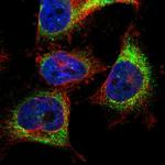 TMCC3 Polyclonal Antibody