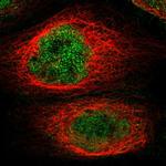 KCTD10 Polyclonal Antibody