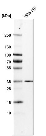 KCTD10 Antibody in Western Blot (WB)