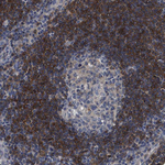 ARHGAP24 Polyclonal Antibody