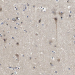 ARHGAP24 Antibody in Immunohistochemistry (Paraffin) (IHC (P))