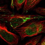 C18orf19 Polyclonal Antibody