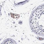C18orf19 Antibody in Immunohistochemistry (Paraffin) (IHC (P))