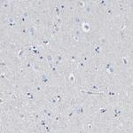 FDCSP Polyclonal Antibody