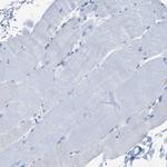 FDCSP Antibody in Immunohistochemistry (Paraffin) (IHC (P))