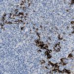 FDCSP Antibody in Immunohistochemistry (Paraffin) (IHC (P))