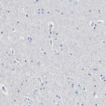 FDCSP Antibody in Immunohistochemistry (IHC)