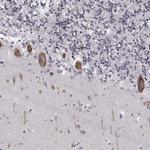 MARCH4 Polyclonal Antibody