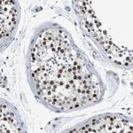 SMCO2 Antibody in Immunohistochemistry (Paraffin) (IHC (P))