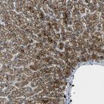 SIGLEC14 Polyclonal Antibody