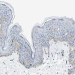 SDR42E1 Polyclonal Antibody