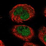TMEM194A Polyclonal Antibody