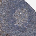 TMEM194A Antibody in Immunohistochemistry (Paraffin) (IHC (P))