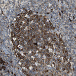 TMEM200A Polyclonal Antibody