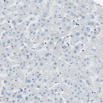 TMEM200A Antibody in Immunohistochemistry (Paraffin) (IHC (P))