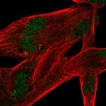 MSANTD4 Polyclonal Antibody