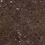 MSANTD4 Antibody in Immunohistochemistry (Paraffin) (IHC (P))