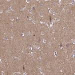 CDH18 Polyclonal Antibody