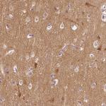 KIAA0513 Polyclonal Antibody