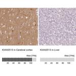 KIAA0513 Antibody in Immunohistochemistry (IHC)