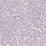 KIAA0513 Antibody in Immunohistochemistry (IHC)