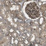 MSRB3 Antibody in Immunohistochemistry (Paraffin) (IHC (P))