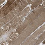 MSRB3 Antibody in Immunohistochemistry (Paraffin) (IHC (P))