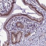 CEACAM19 Polyclonal Antibody