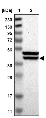 KLHDC8B Antibody in Western Blot (WB)