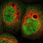 ABHD15 Polyclonal Antibody